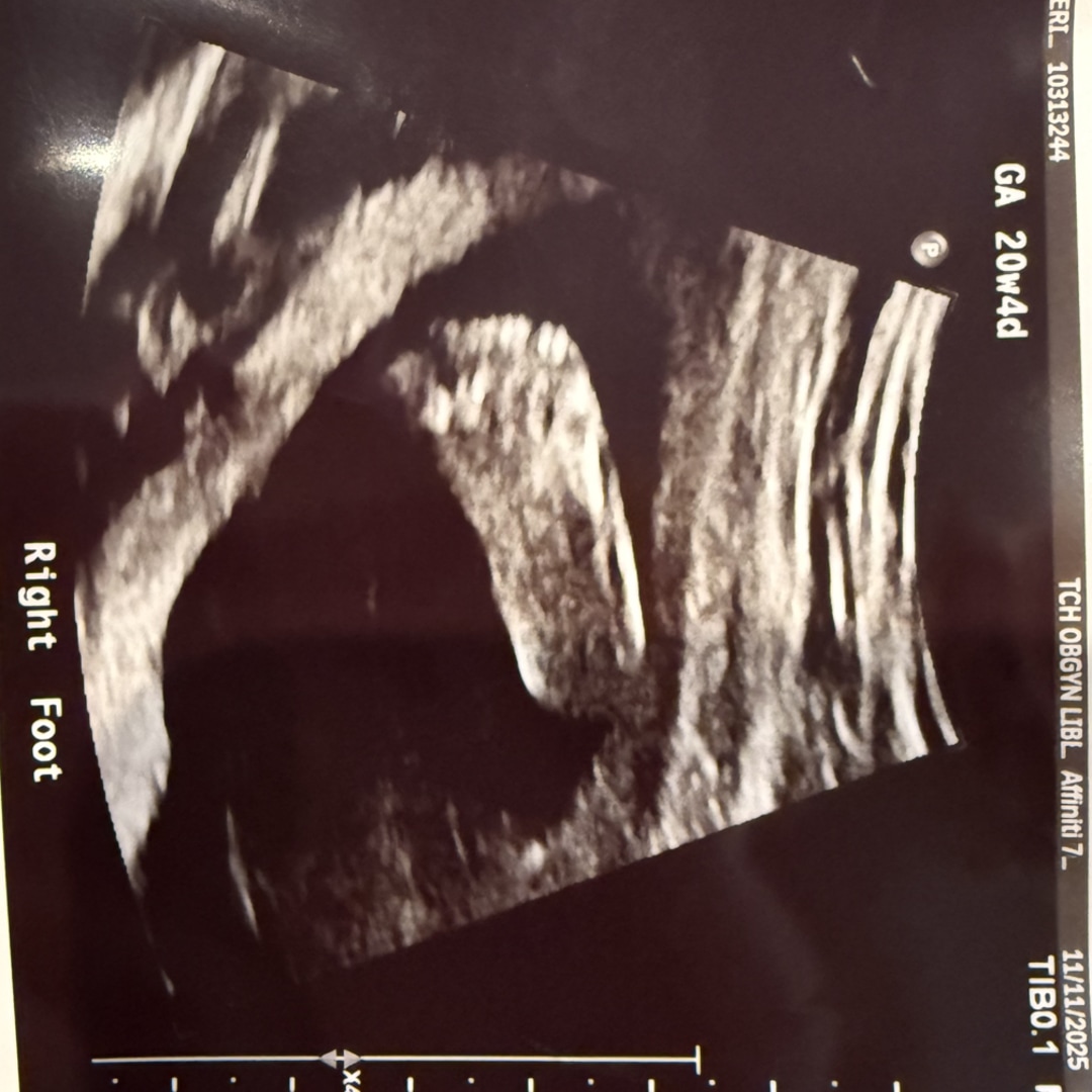 Photo shared by Kate for their Babylist baby registry.