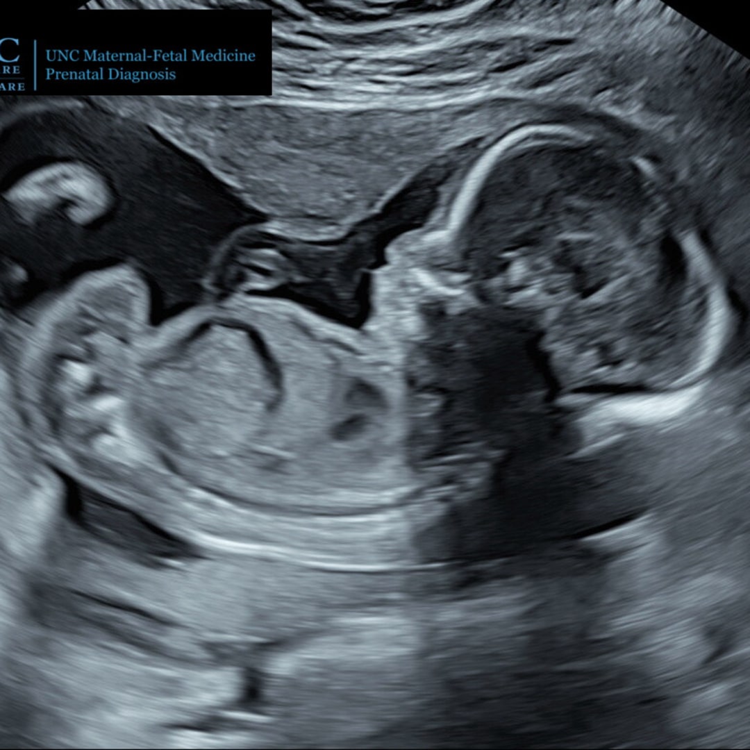 Photo shared by Brittany for their Babylist baby registry.