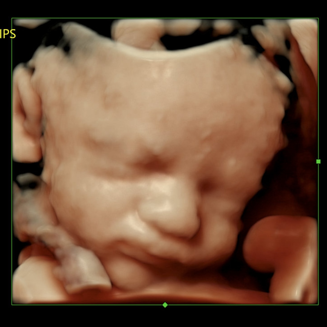 Photo shared by Sarahi for their Babylist baby registry.