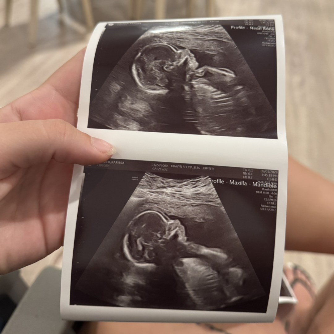 Photo shared by Karissa for their Babylist baby registry.