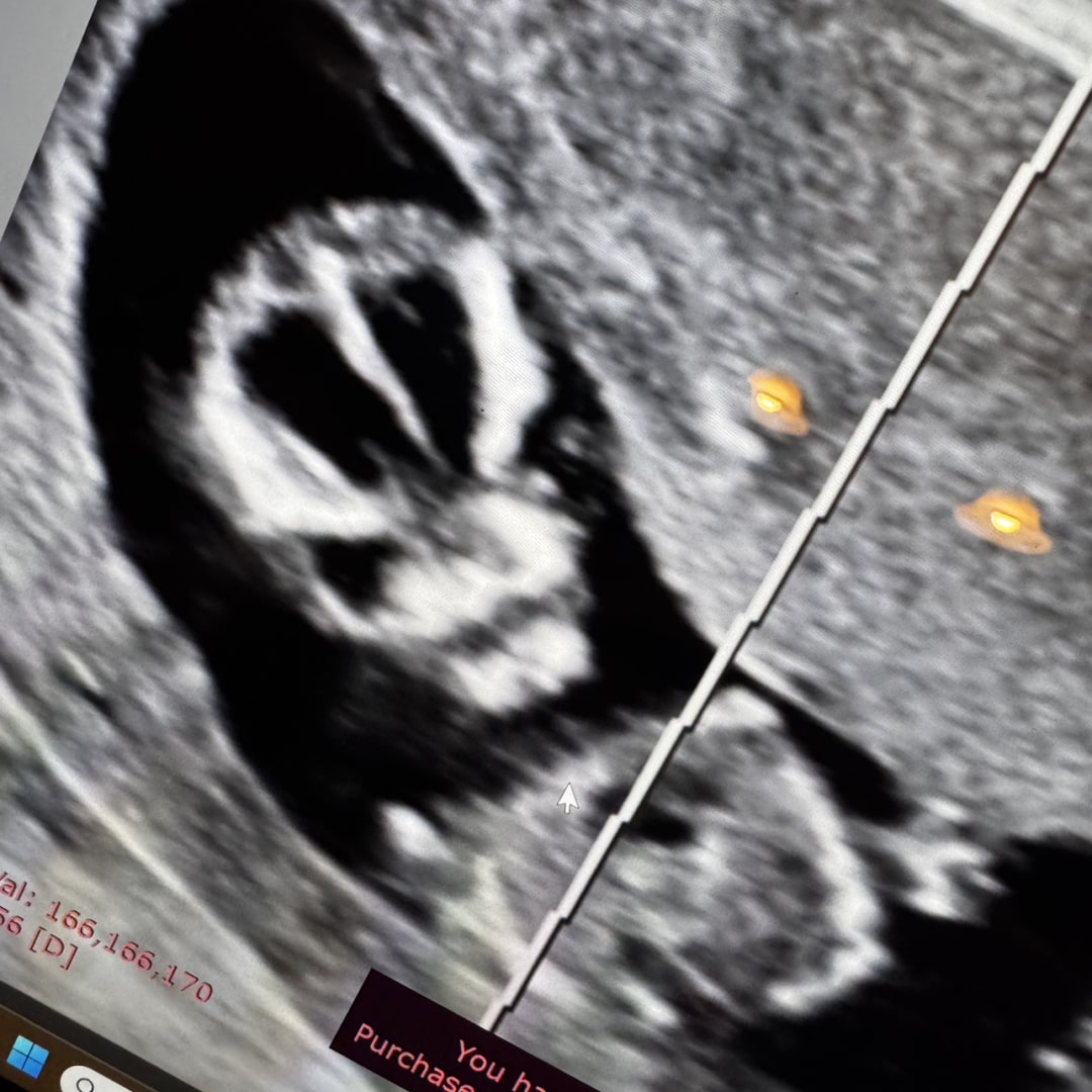 Photo shared by Ben for their Babylist baby registry.