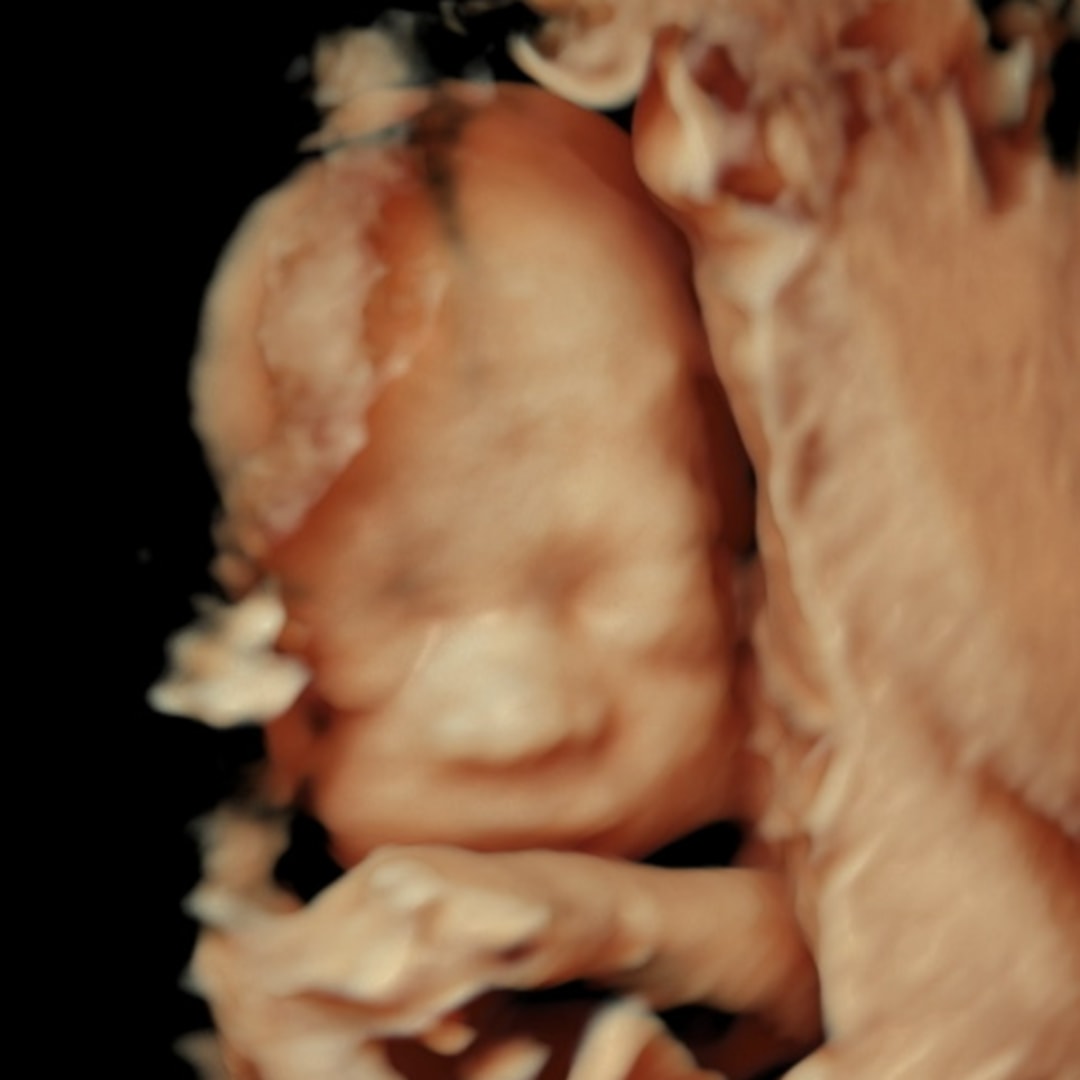 Photo shared by Yarely for their Babylist baby registry.