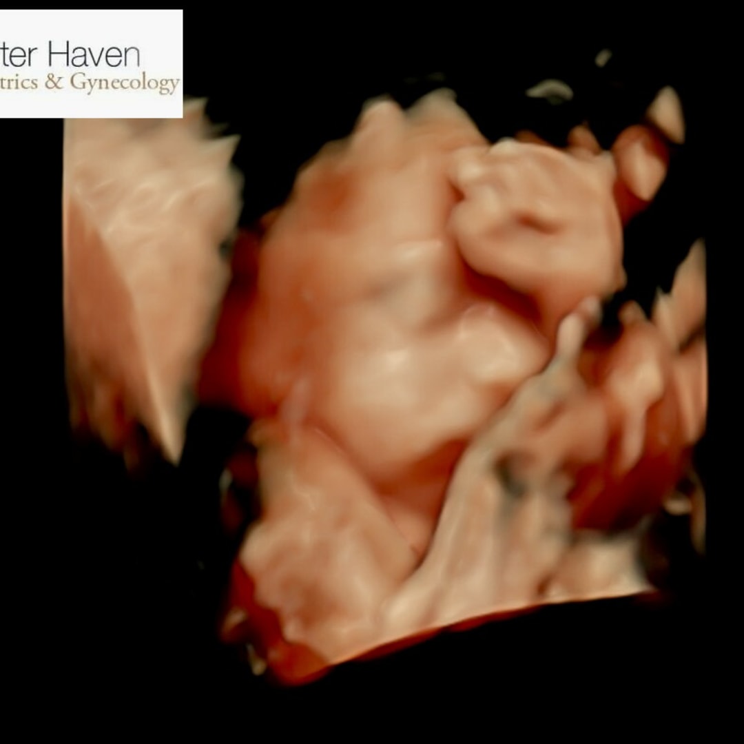 Photo shared by Jackie for their Babylist baby registry.