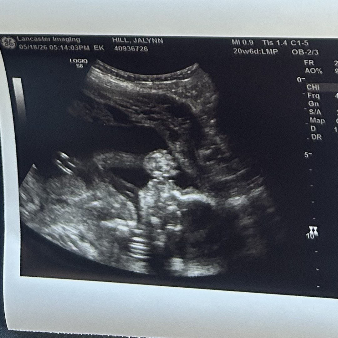 Photo shared by Jalynn for their Babylist baby registry.