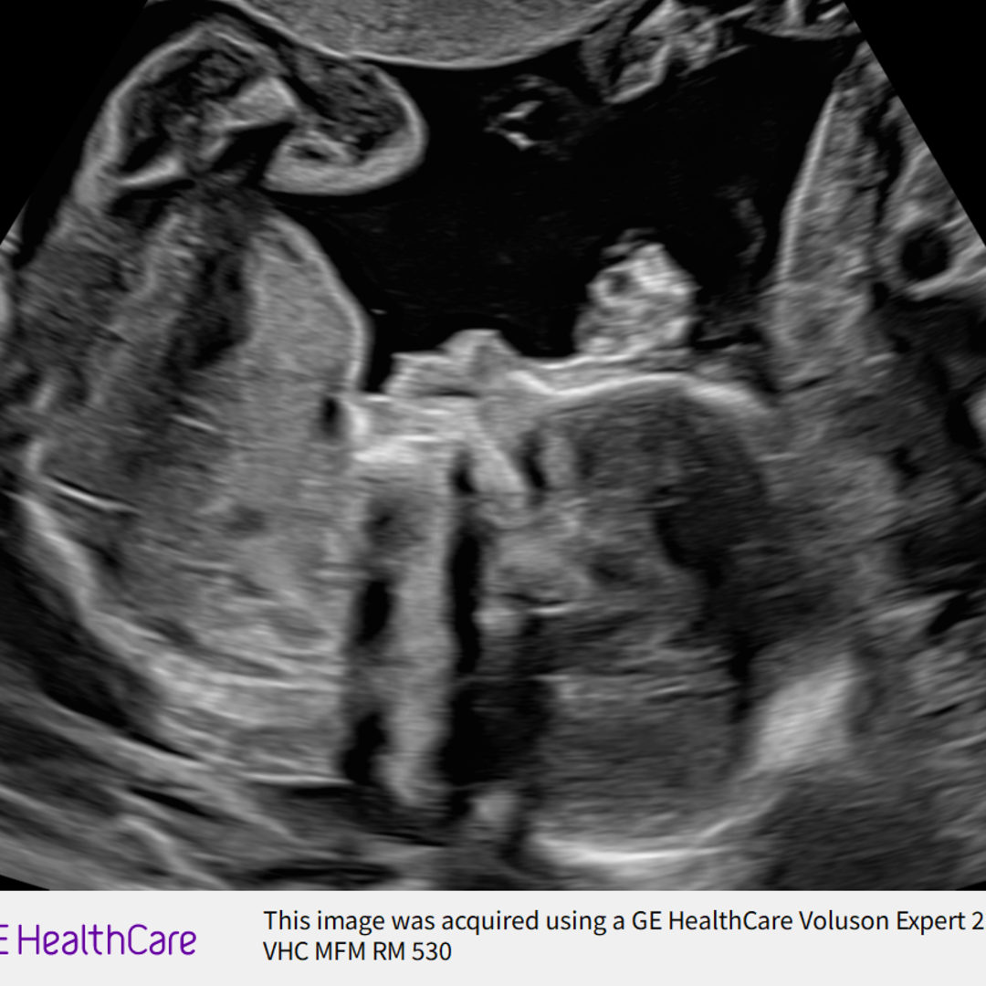 Photo shared by Kristin for their Babylist baby registry.