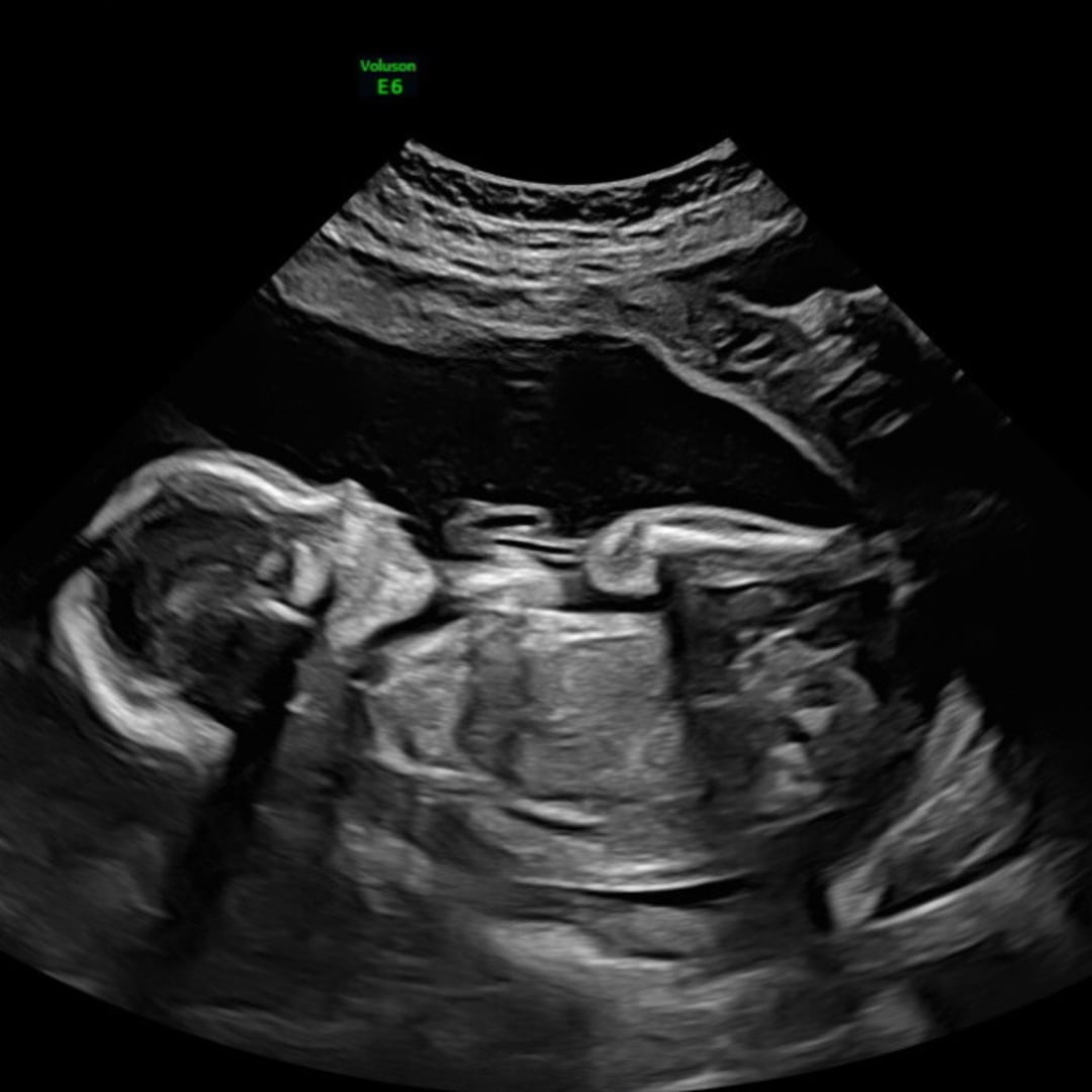 Photo shared by Brandi for their Babylist baby registry.