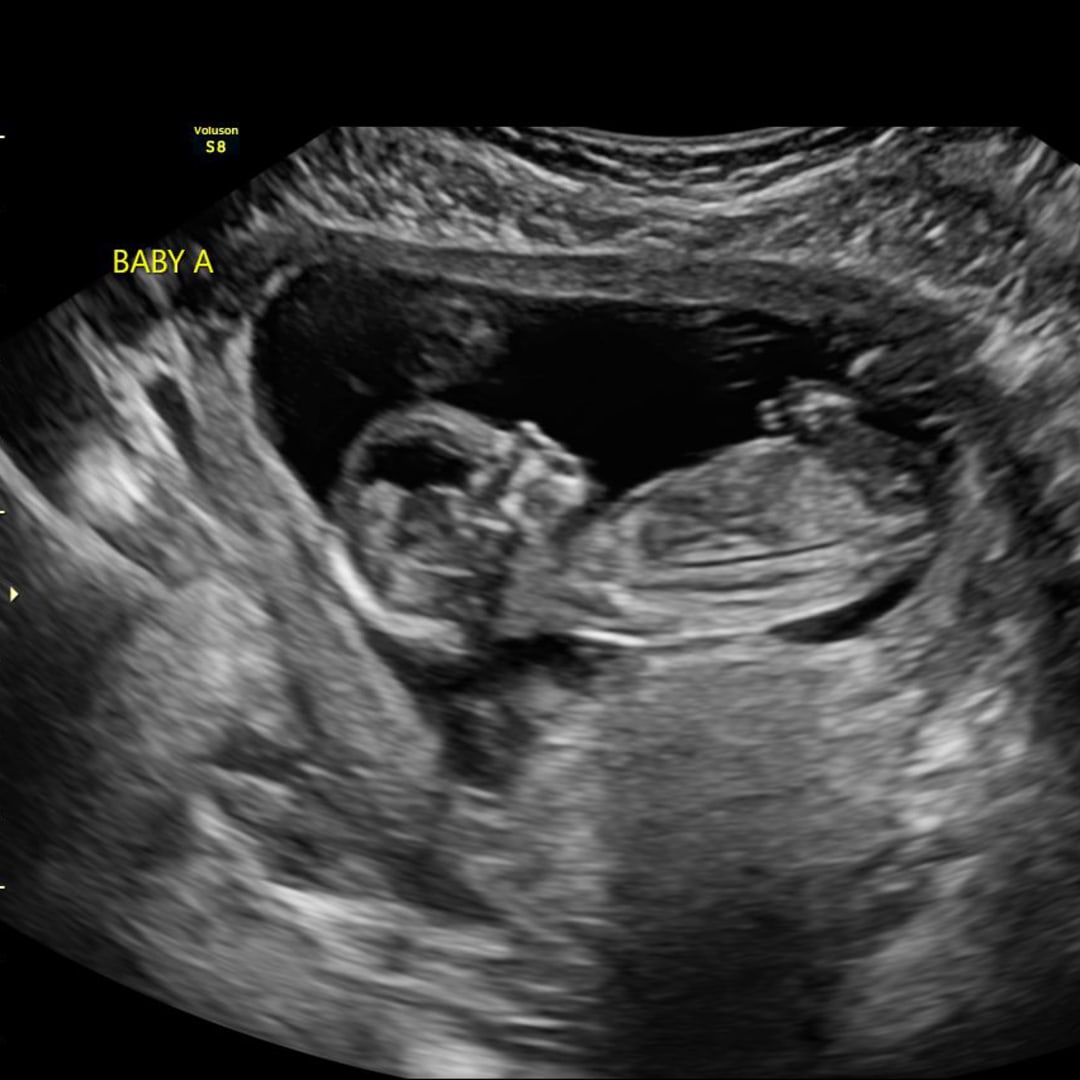 Photo shared by Carrie for their Babylist baby registry.