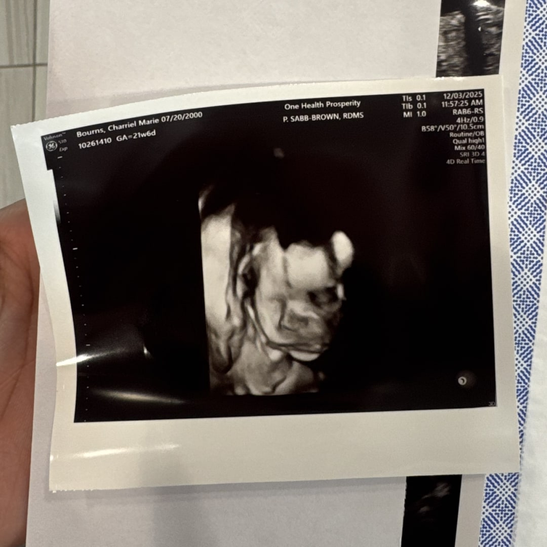 Photo shared by Charriel for their Babylist baby registry.