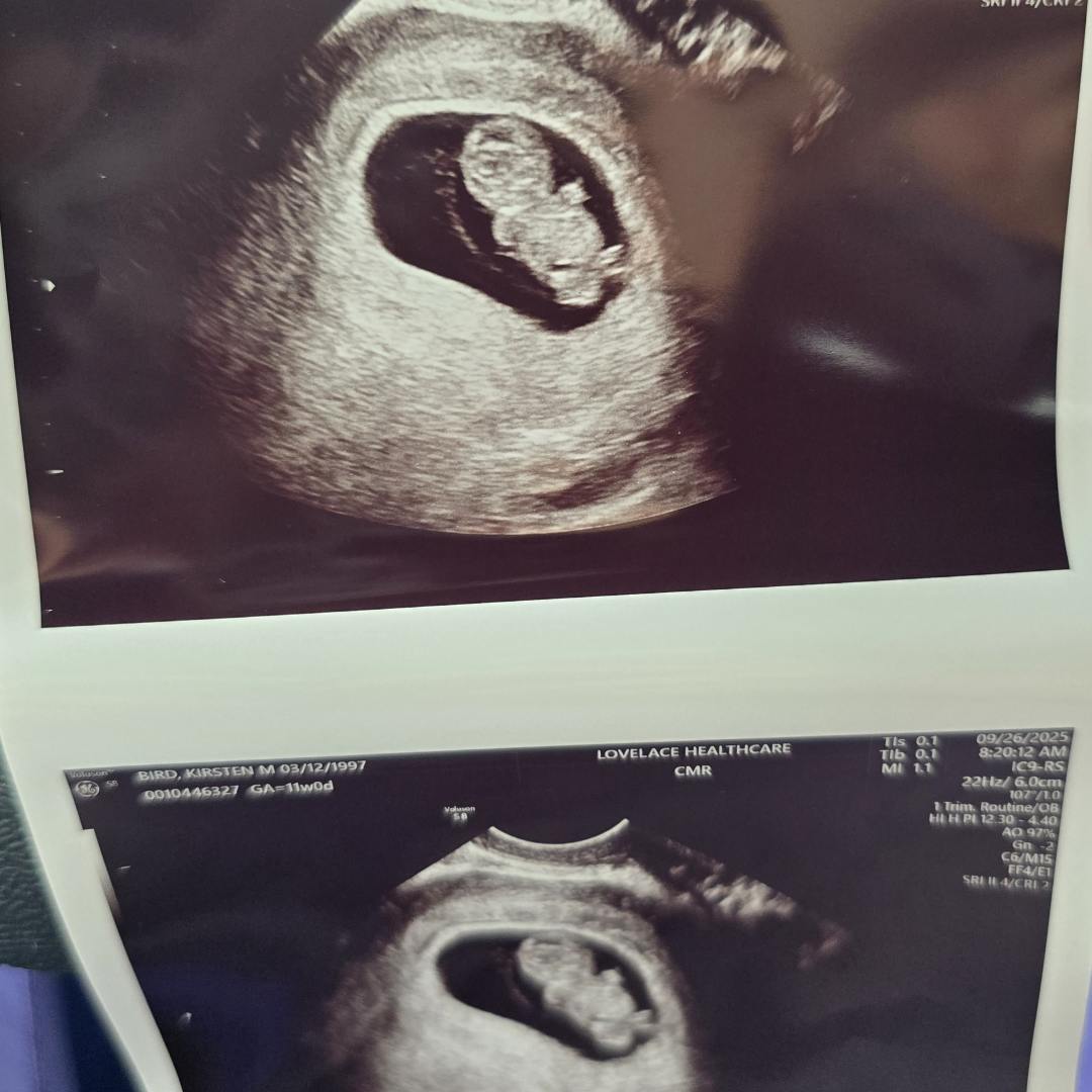 Photo shared by Kirsten for their Babylist baby registry.