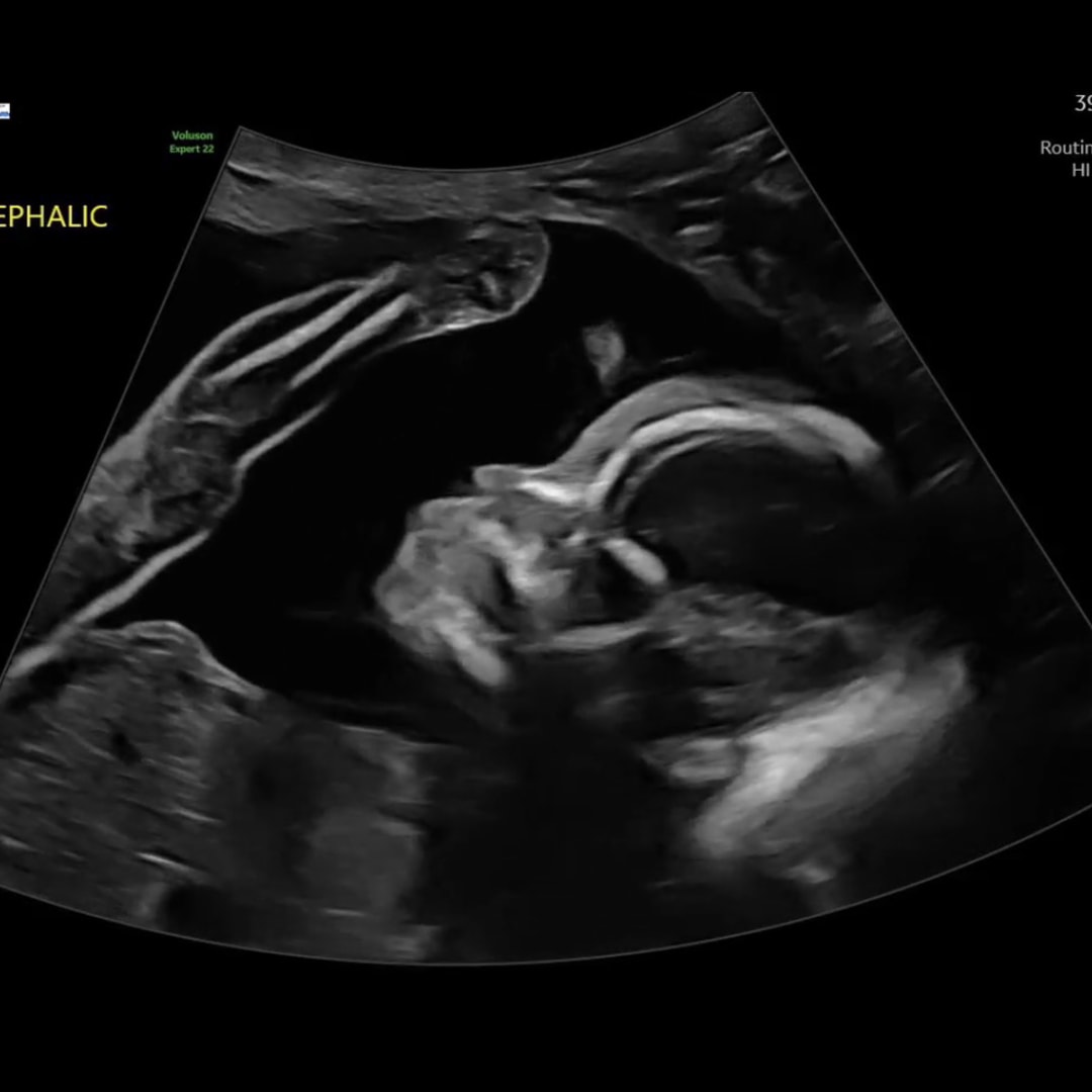 Photo shared by Fatima for their Babylist baby registry.