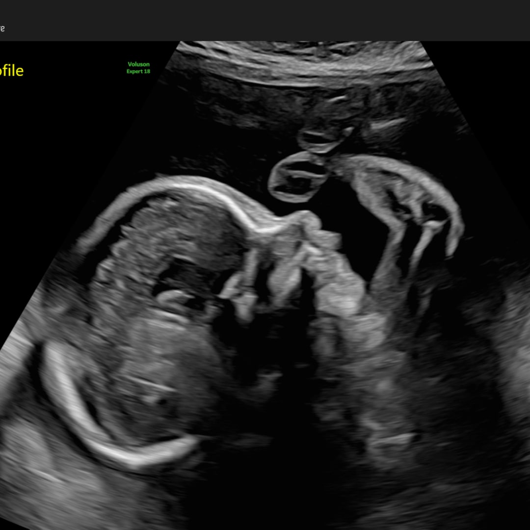 Photo shared by Krista for their Babylist baby registry.