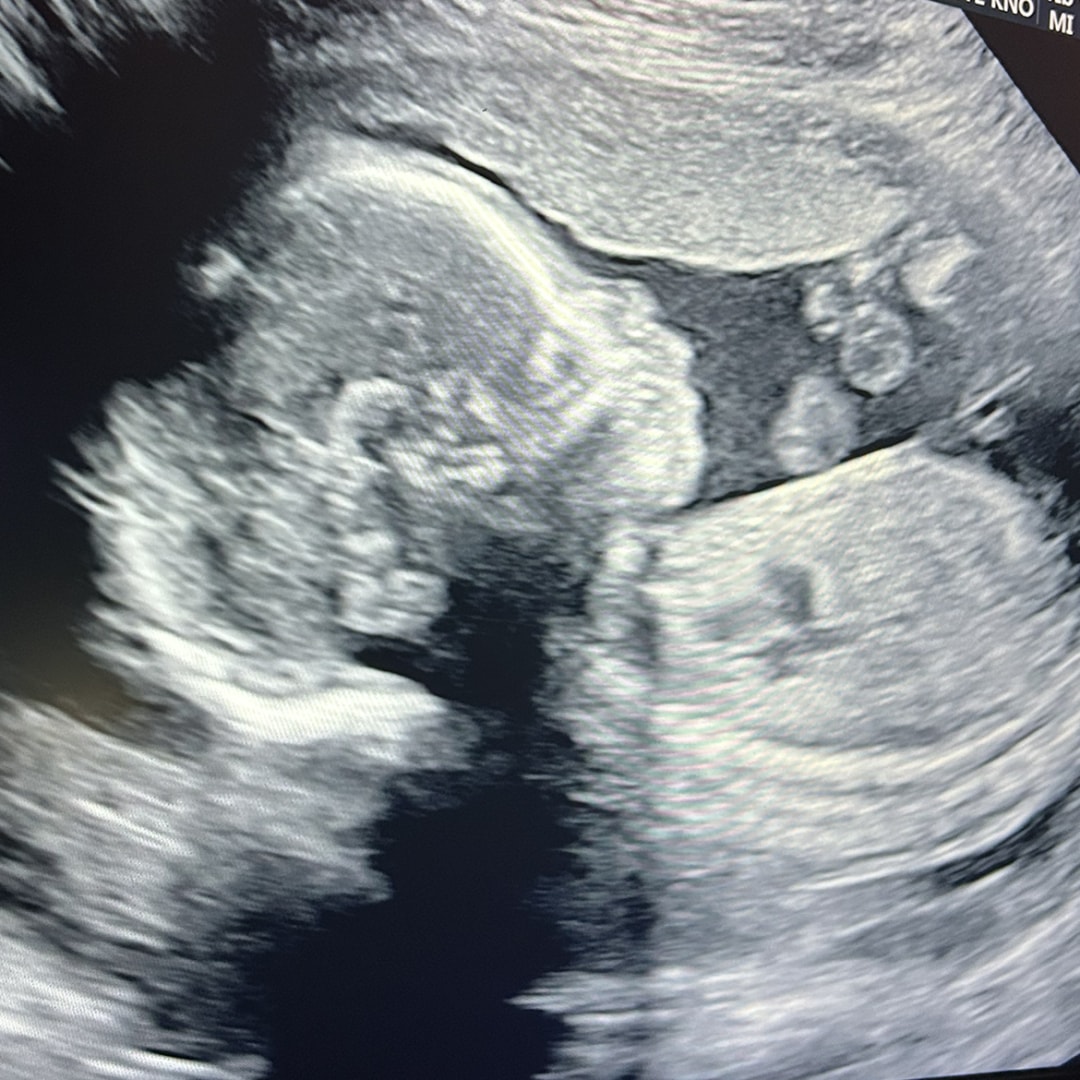 Photo shared by Rachael for their Babylist baby registry.