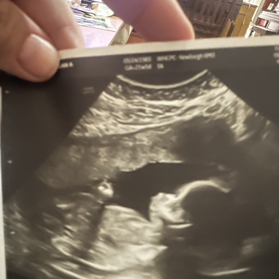 Photo shared by Megan for their Babylist baby registry.