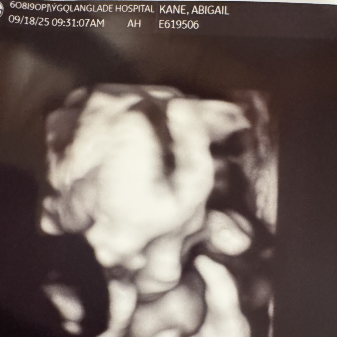 Photo shared by Abby for their Babylist baby registry.