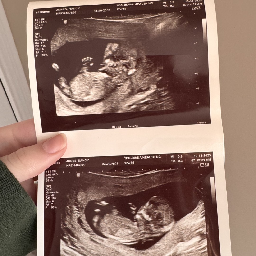 Photo shared by Nancy for their Babylist baby registry.