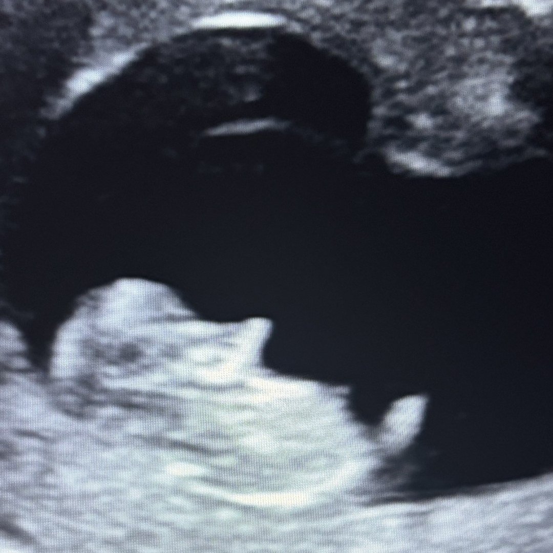 Photo shared by Christopher for their Babylist baby registry.