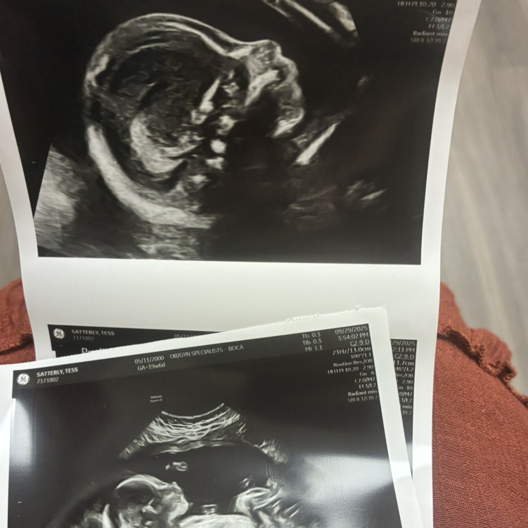 Photo shared by Tess for their Babylist baby registry.