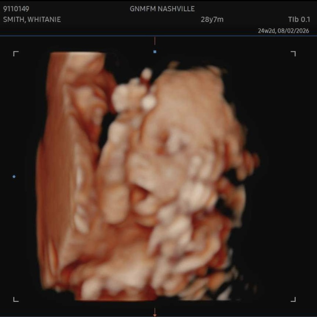 Photo shared by Whitanie for their Babylist baby registry.