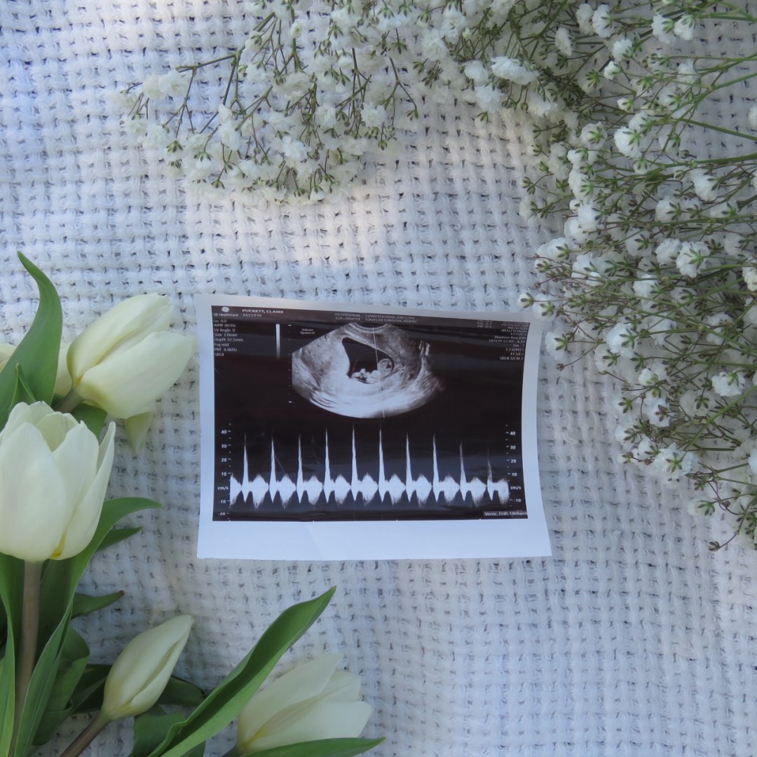 Photo shared by Claire for their Babylist baby registry.