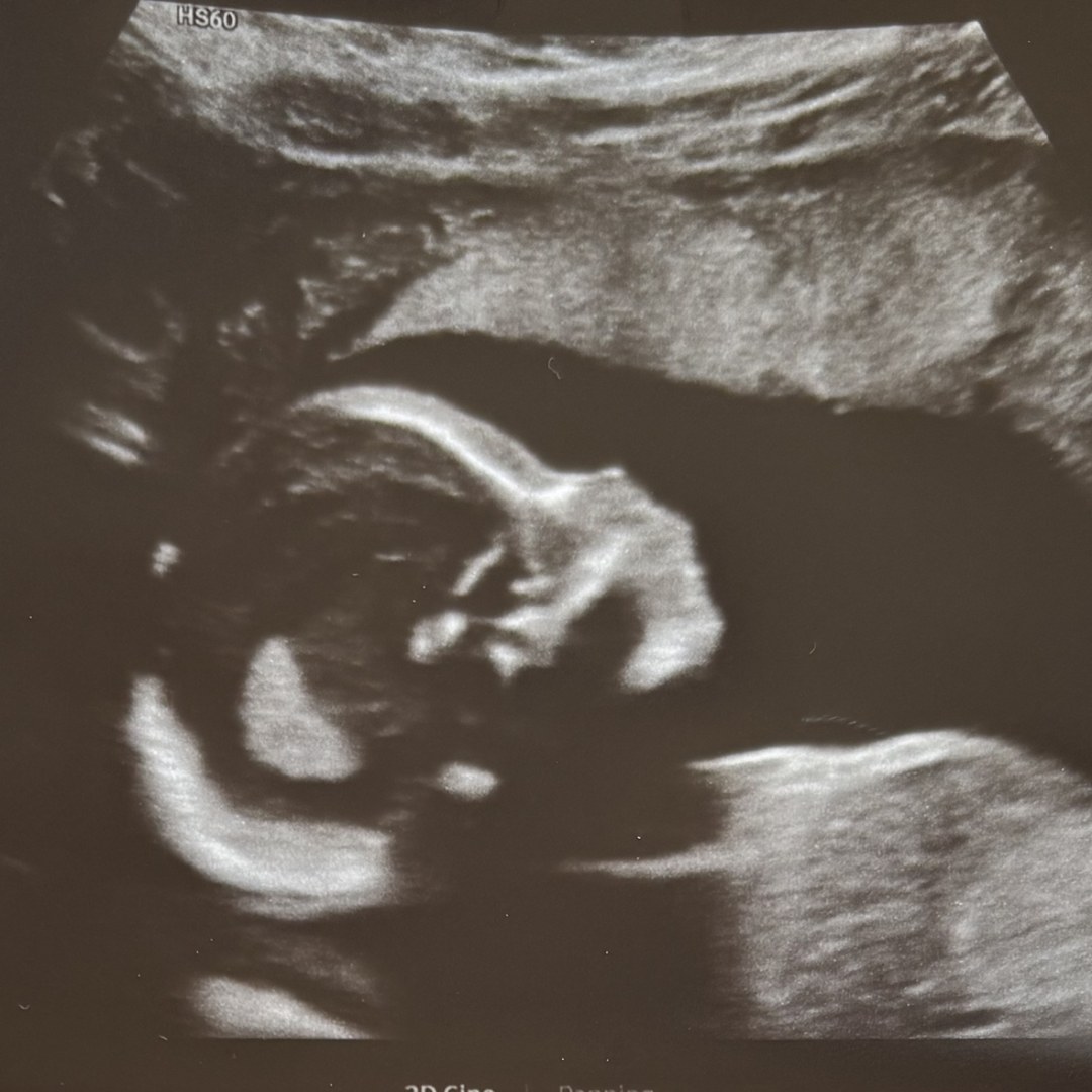 Photo shared by Clara for their Babylist baby registry.