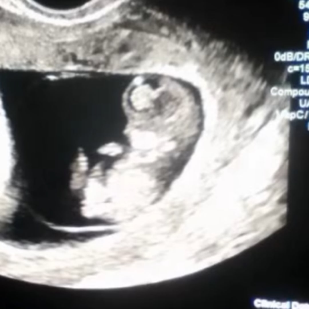 Photo shared by Aryanna for their Babylist baby registry.