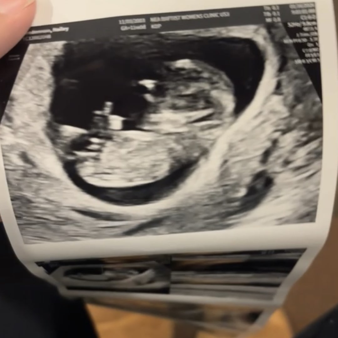 Photo shared by Hailey for their Babylist baby registry.