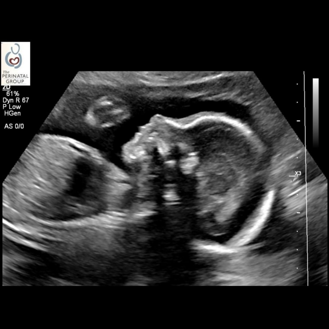 Photo shared by Halie for their Babylist baby registry.