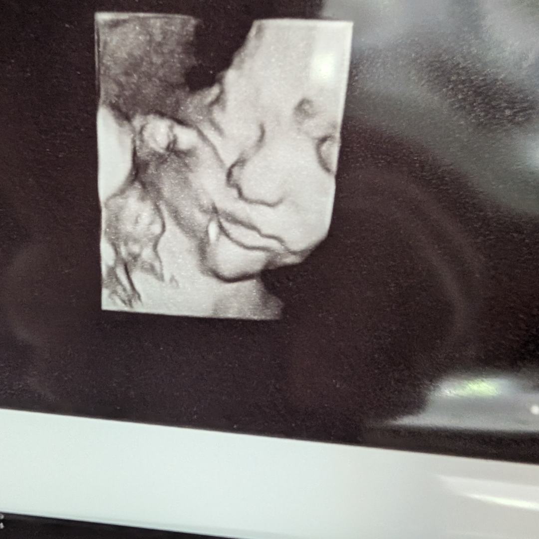 Photo shared by Lina for their Babylist baby registry.