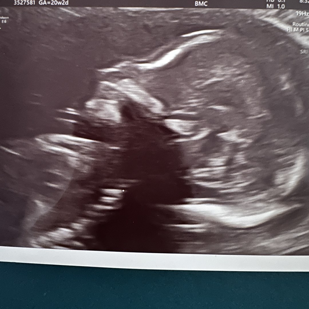 Photo shared by Elba for their Babylist baby registry.