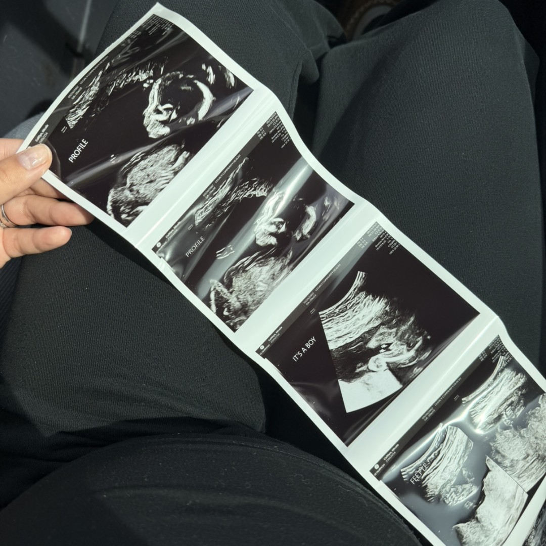 Photo shared by Nicole Kay for their Babylist baby registry.