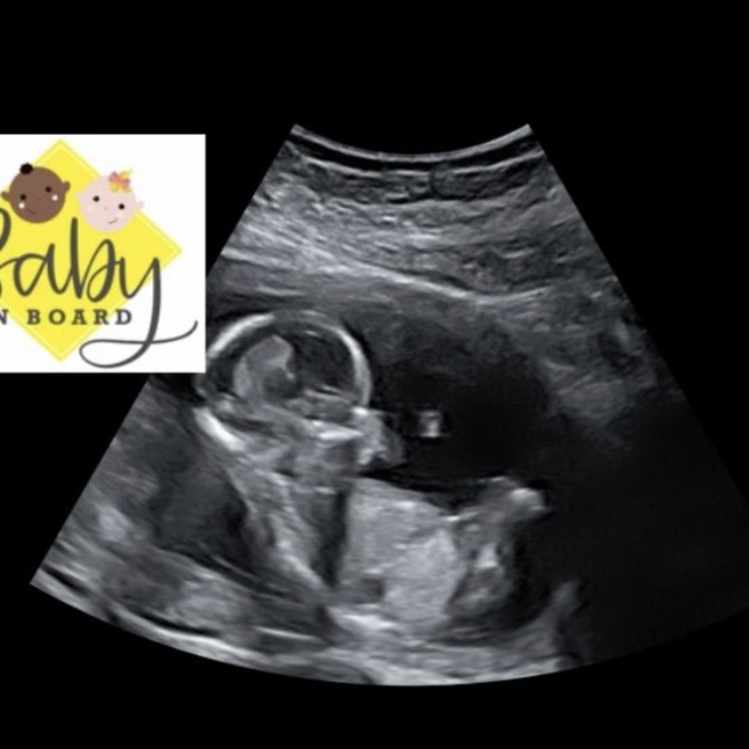 Photo shared by Haylie for their Babylist baby registry.