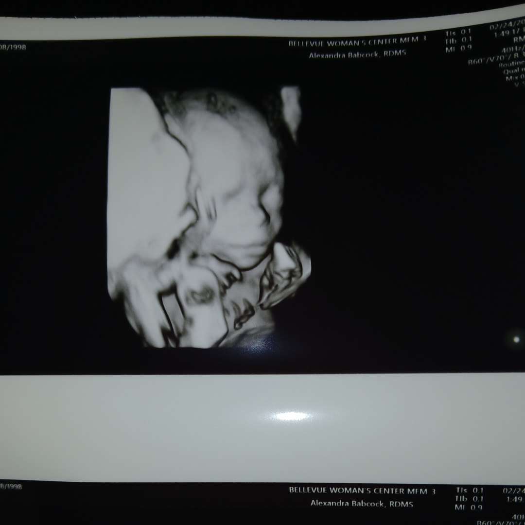 Photo shared by Janelle for their Babylist baby registry.