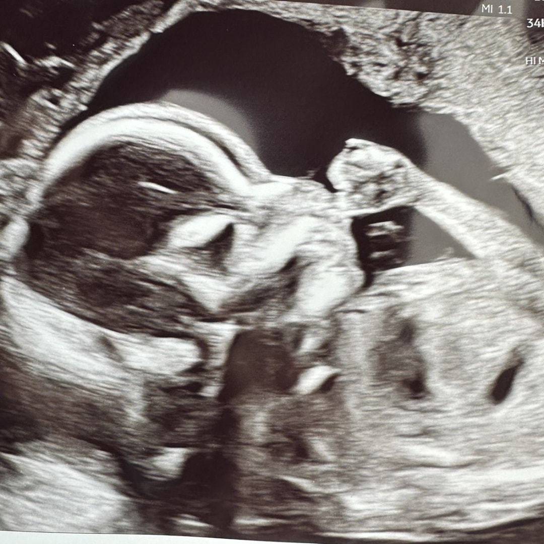 Photo shared by Amanda for their Babylist baby registry.