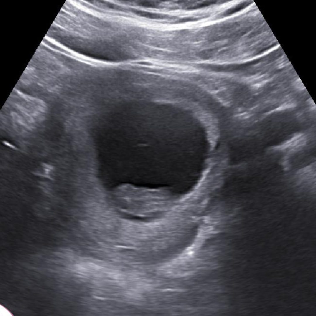 Photo shared by Jocelyn for their Babylist baby registry.