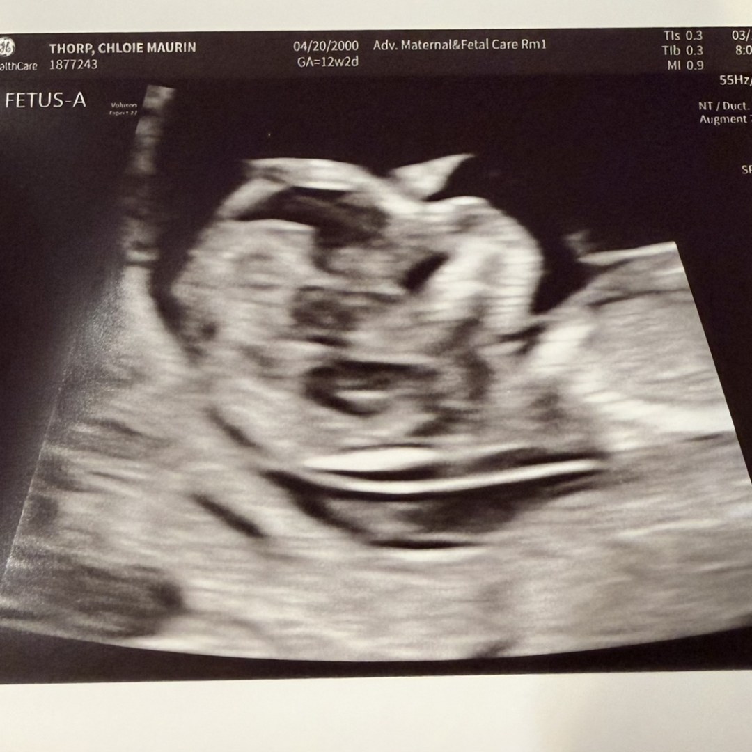 Photo shared by Chloie for their Babylist baby registry.