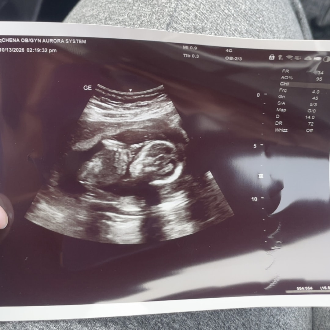 Photo shared by Erica for their Babylist baby registry.