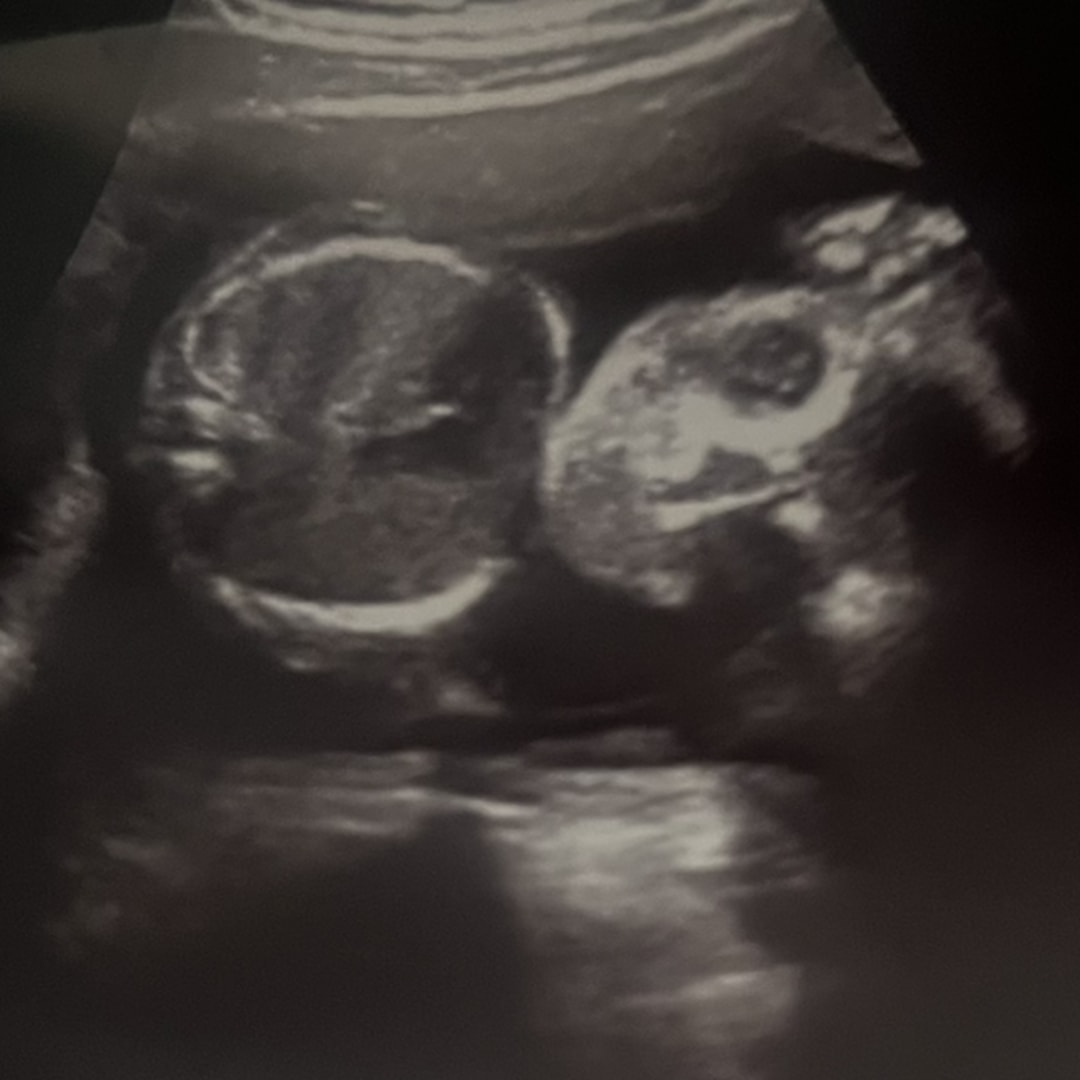 Photo shared by Ityonnuia for their Babylist baby registry.