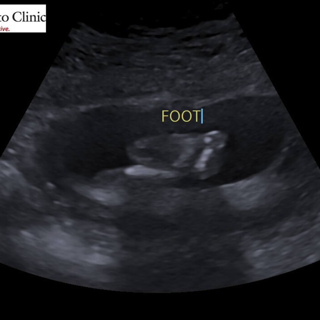 Photo shared by Adria for their Babylist baby registry.