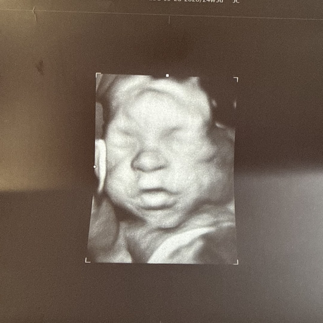 Photo shared by Annastasia for their Babylist baby registry.