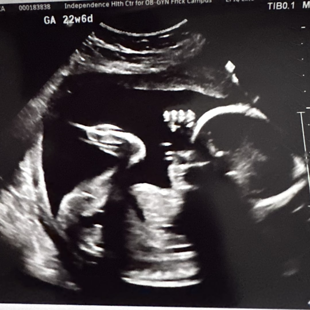 Photo shared by Jessica for their Babylist baby registry.