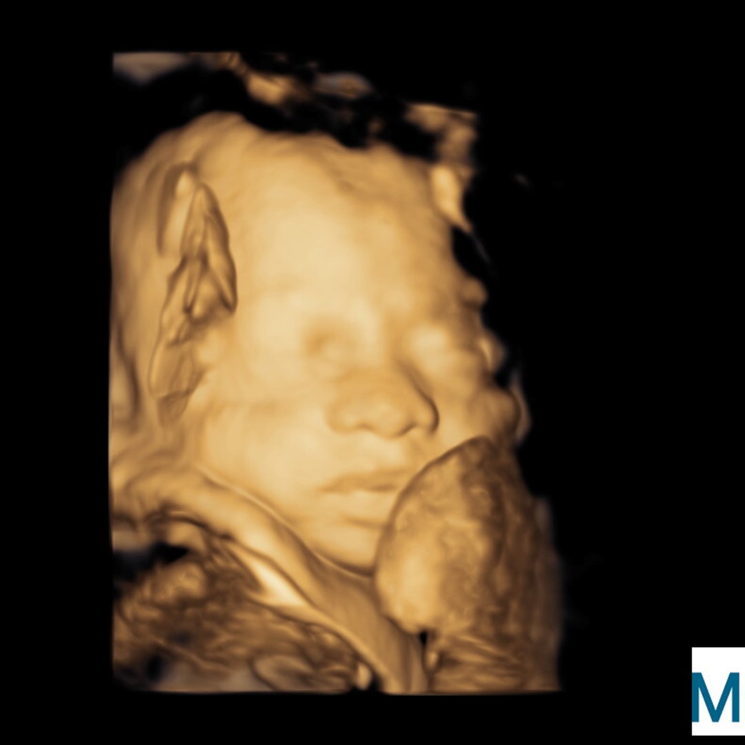Photo shared by Paige for their Babylist baby registry.