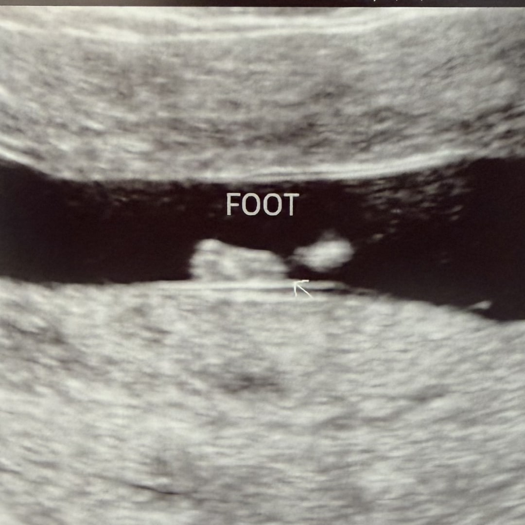 Photo shared by Shelby for their Babylist baby registry.
