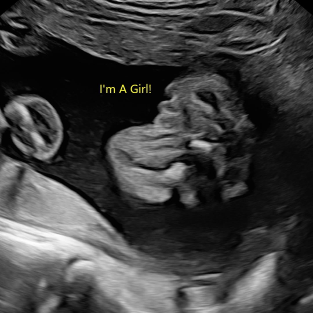 Photo shared by JaQuavius for their Babylist baby registry.