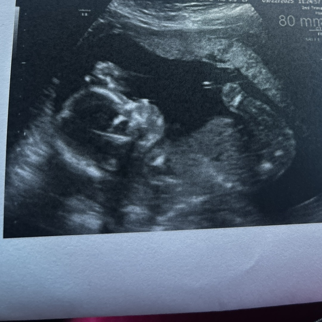 Photo shared by Alyssa for their Babylist baby registry.