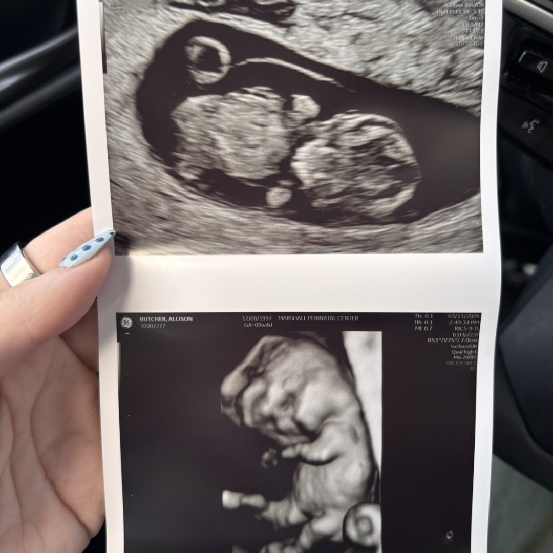 Photo shared by Allison for their Babylist baby registry.