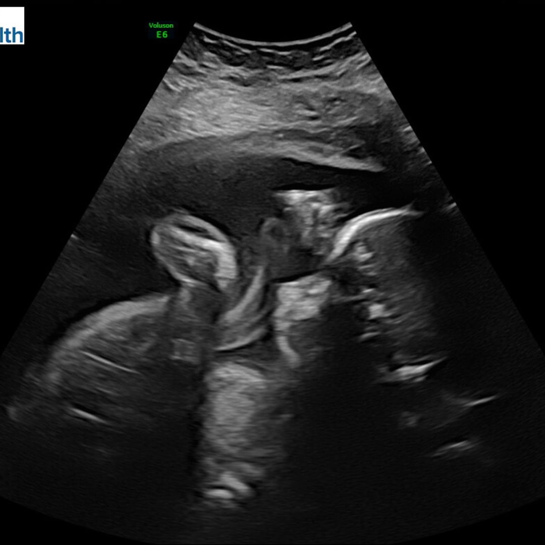 Photo shared by Adriana for their Babylist baby registry.