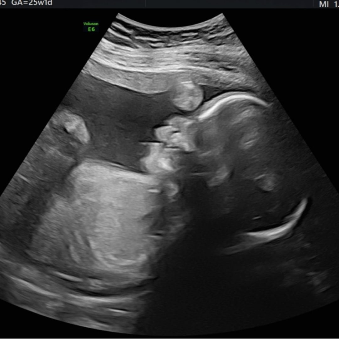 Photo shared by Stephanie for their Babylist baby registry.