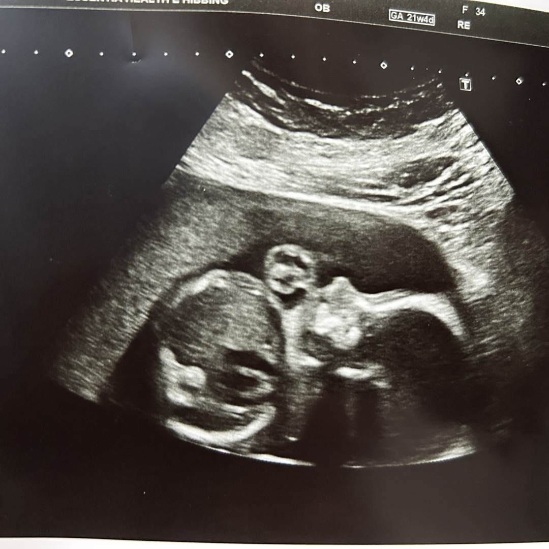 Photo shared by Kayla for their Babylist baby registry.