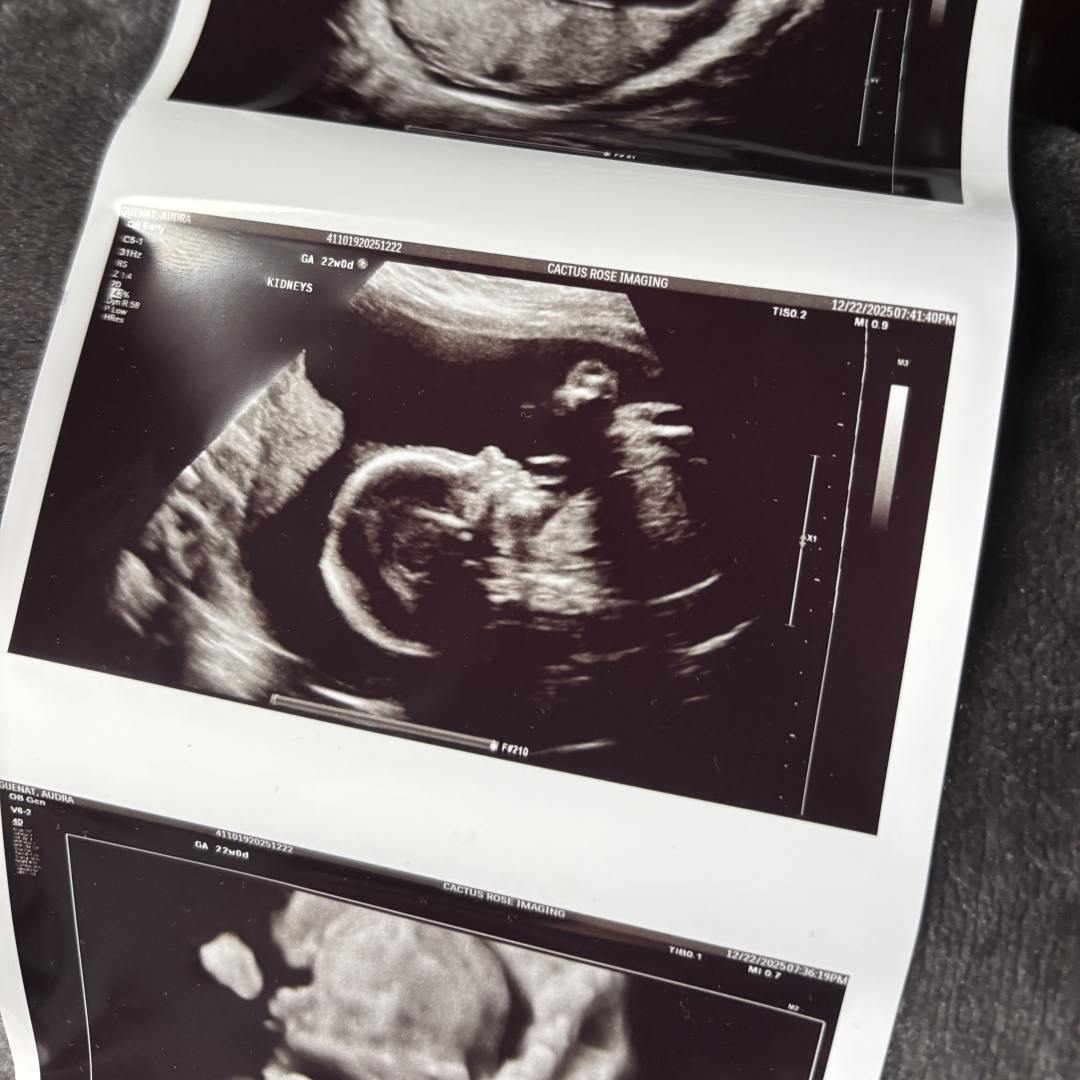 Photo shared by Audra for their Babylist baby registry.