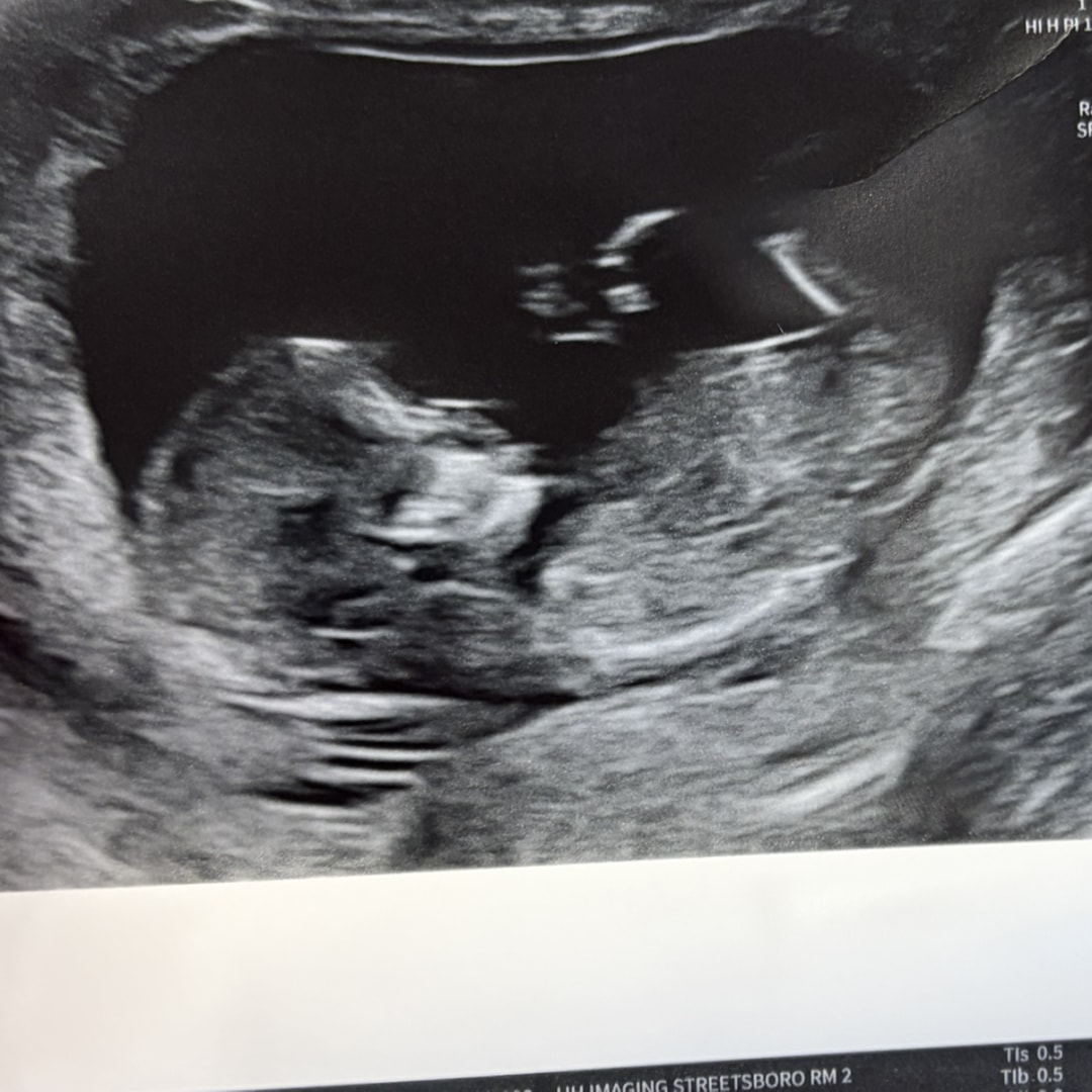 Photo shared by Samantha for their Babylist baby registry.